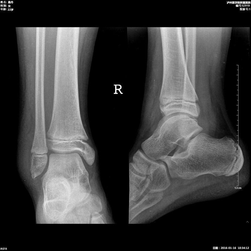 醫(yī)用膠片（B超、CT、DR）、自動取片機
