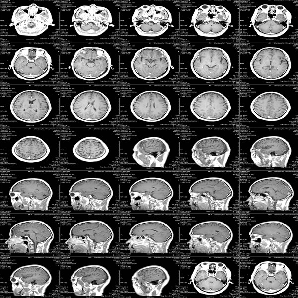 A3瓷白膠片廠家|彩色激光打印醫(yī)用膠片| 醫(yī)療A3|激光膠片