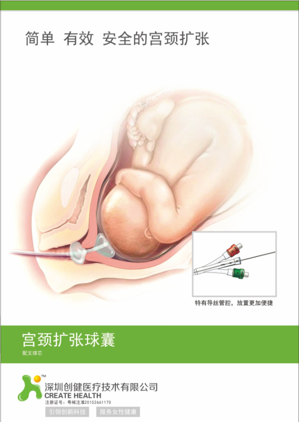 產(chǎn)科耗材子宮頸擴張球囊   全國招商
