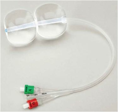 高空間利潤品種創(chuàng)健宮頸擴(kuò)張球囊誠邀各地代理商合作