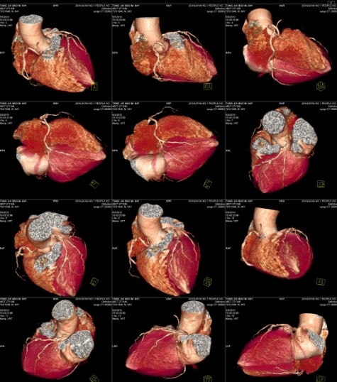 超高清PET醫(yī)用膠片