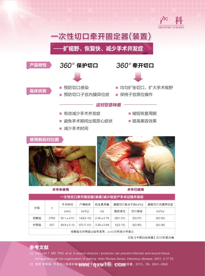一次性切口牽開固定器（裝置）