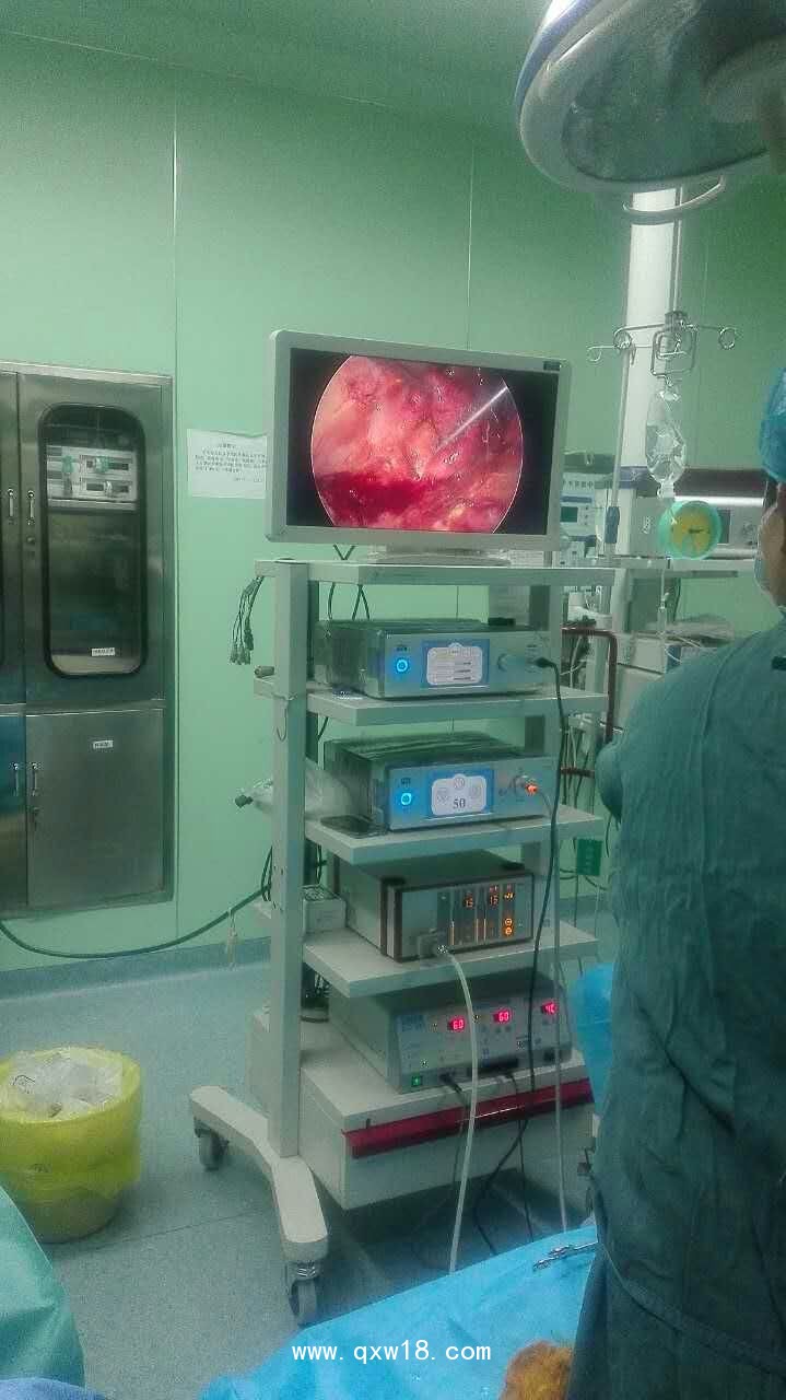 德國MGB高清腹腔鏡，高清膀胱鏡，高清輸尿管腎鏡，鼻竇鏡