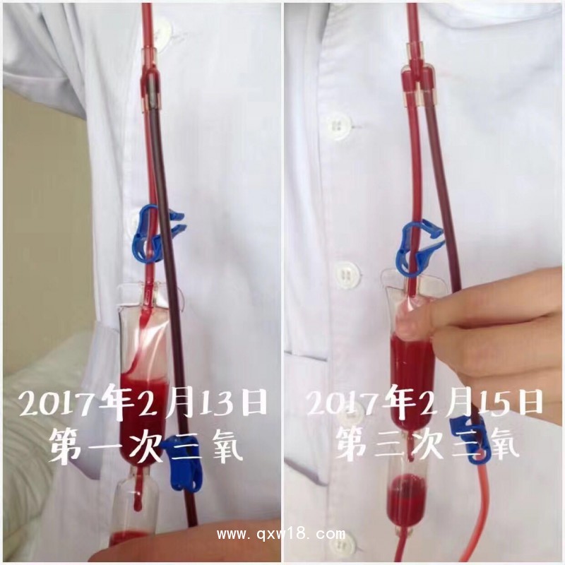 意大利歐恩蘭進口醫(yī)用臭氧治療儀