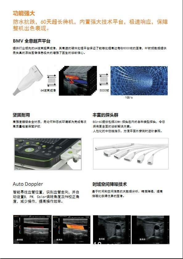 B超，監(jiān)護(hù)儀，心電圖，血壓計(jì)