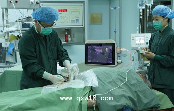 筆記本b超機,便攜式彩超機,便攜式b超機