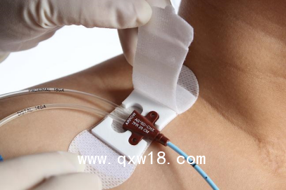 醫(yī)用導(dǎo)管夾 導(dǎo)管固定帖 B型小