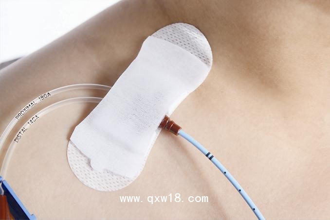 透氣膠貼（非織造布膠帶）B型（小）