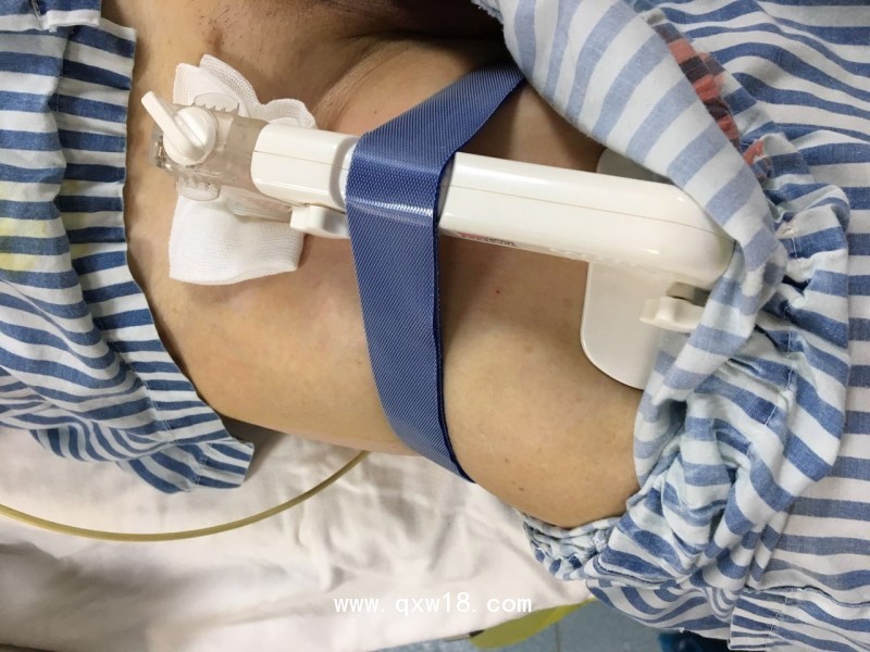 【普亞喜】動(dòng)脈壓迫止血器