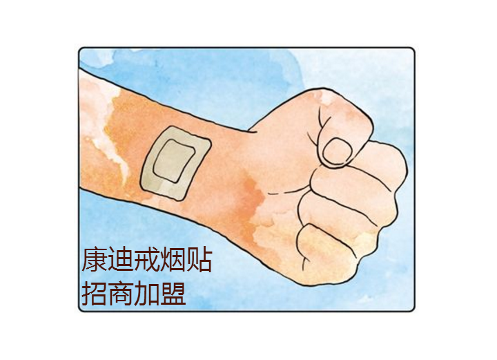 戒煙貼招商加盟康迪專業(yè)戒煙貼加工廠家