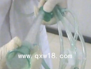 醫(yī)用脈沖沖洗器盈諾