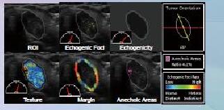 二類醫(yī)療器械--甲狀腺超聲電腦輔助偵測系統(tǒng)