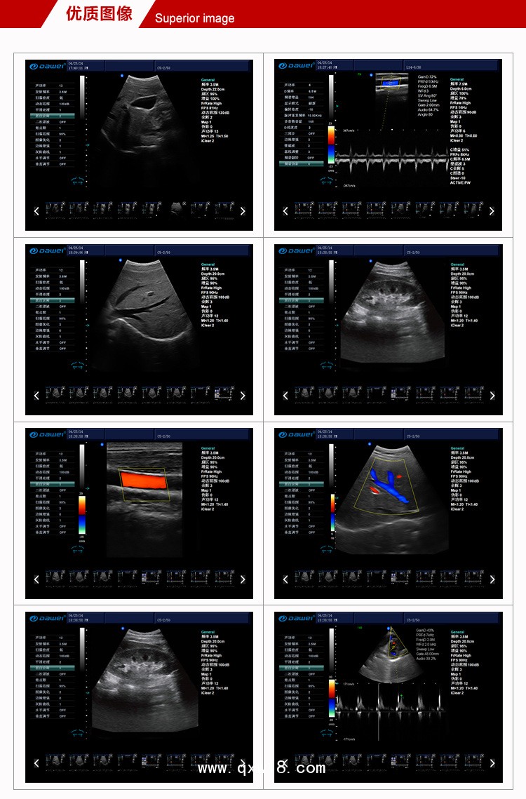 臻譽(yù)（精英版）
