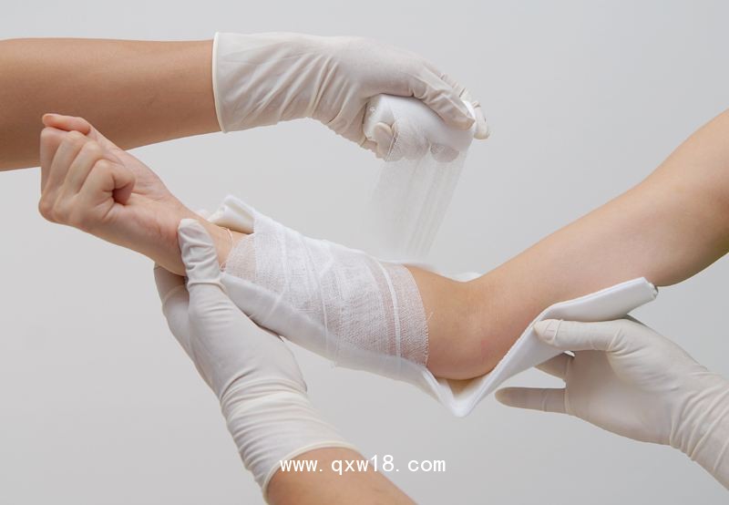 高分子夾板-骨科外固定高分子夾板廠家