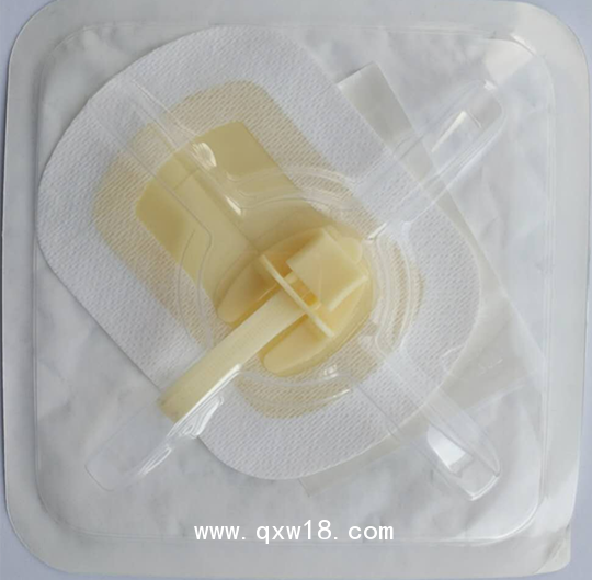 醫(yī)用導(dǎo)管夾