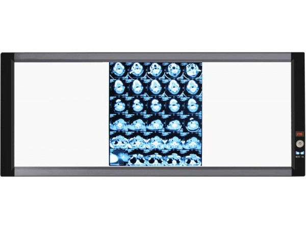 山東眾佳ZJ-G3B 系列LED醫(yī)用超薄液晶觀片燈