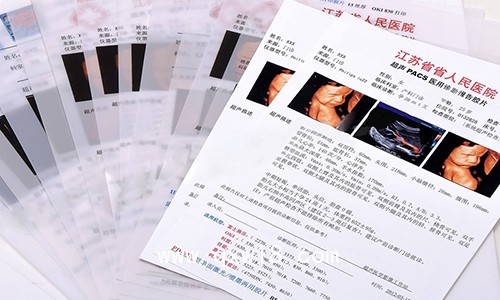 醫(yī)用打印膠片2