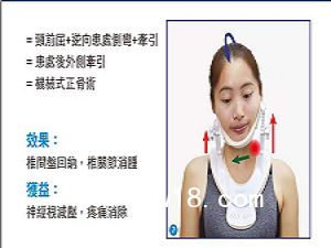 移動(dòng)頸椎牽引器