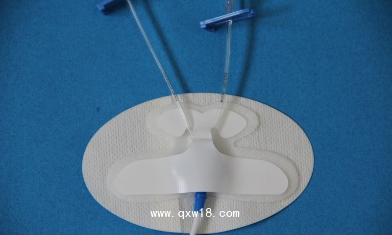 體表導管固定裝置