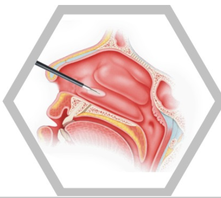 供應(yīng)GD308-P耳鼻喉等離子高頻電刀