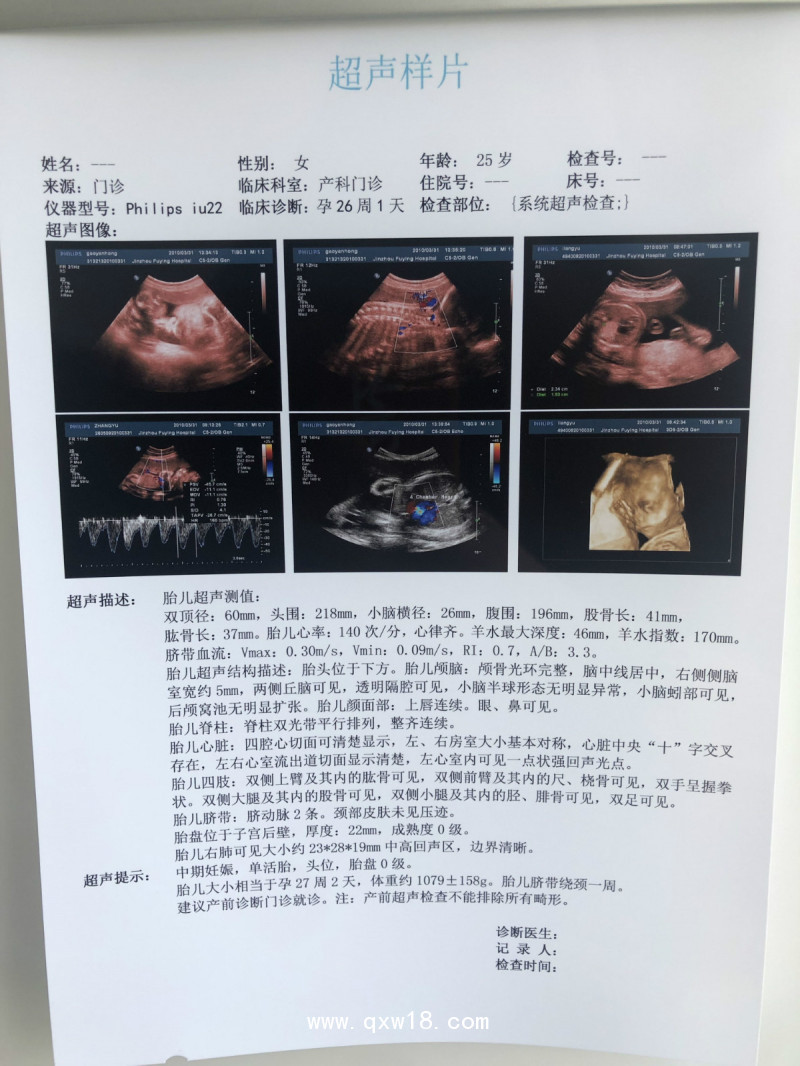 超聲噴墨（激光）A4膠片醫(yī)用膠片