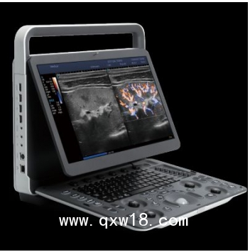 開(kāi)立E1EXP便攜式彩超