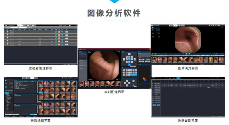 磁控膠囊式內(nèi)窺鏡系統(tǒng)MCS-600