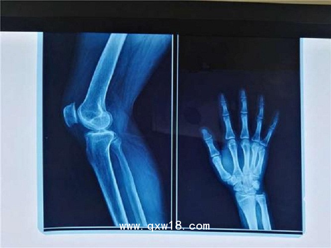 醫(yī)用膠片廠家