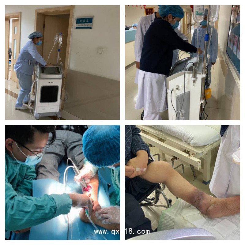 外傷傷口清洗設(shè)備