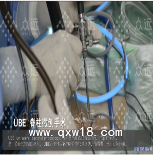 UBE耗材 UBE刀頭 UBE一次性使用電極 UBE器械