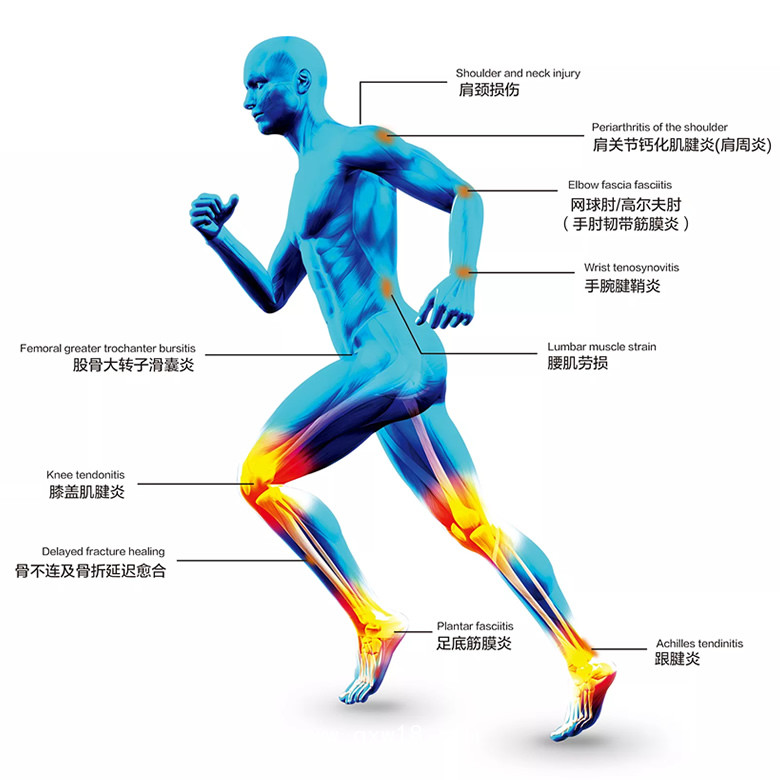 德國(guó)MTS 火花波液電式?jīng)_擊波治療儀