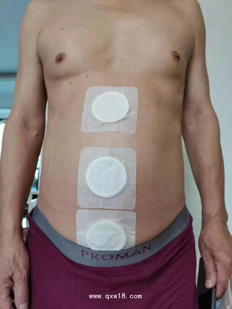 腫瘤止痛產(chǎn)品 癌痛貼   腫瘤科產(chǎn)品