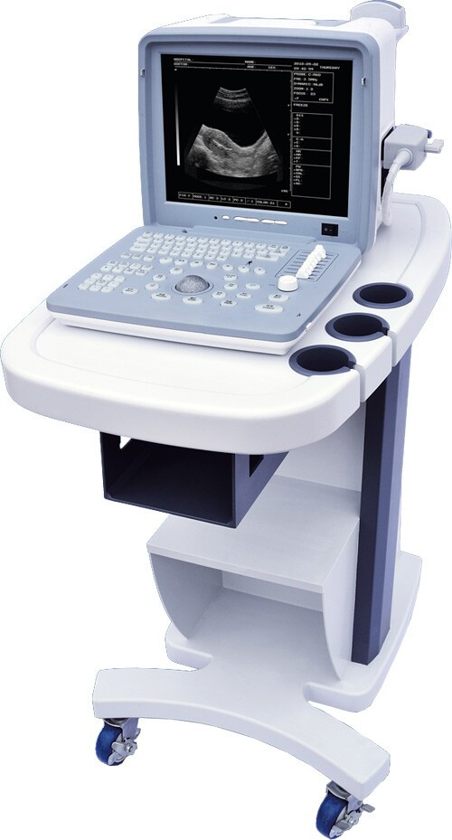 全數(shù)字超聲顯像診斷儀廠家直銷(xiāo)便攜式黑白B超機(jī)