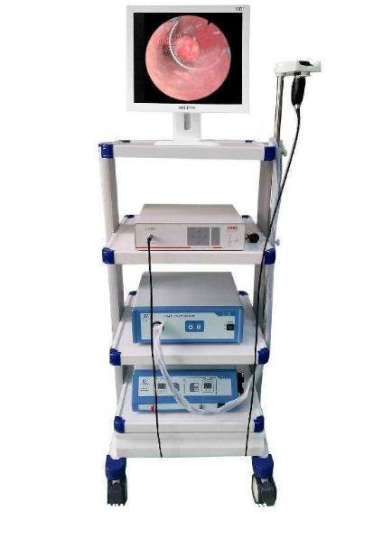 宮腔鏡醫(yī)用高清婦科檢查宮腔鏡高清內窺鏡攝像系統(tǒng)國產宮腔鏡