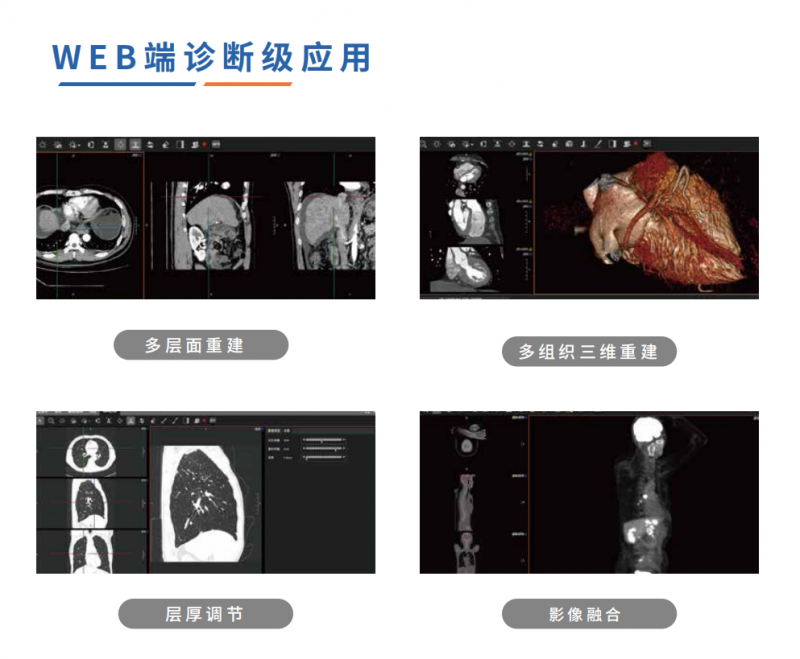 全球影像·數(shù)字影像服務(云膠片)