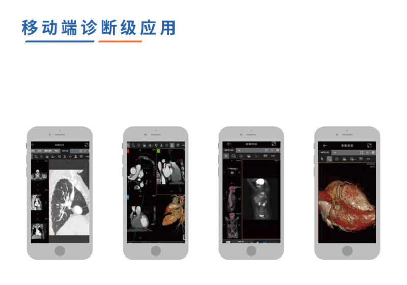 全球影像·數(shù)字影像服務(云膠片)