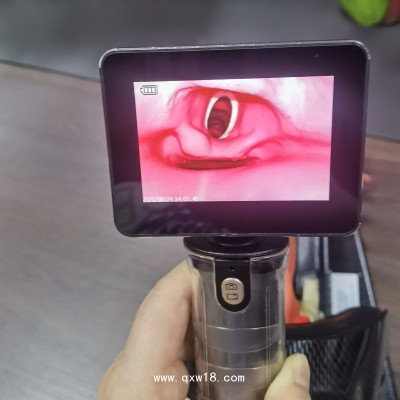 麻醉視頻喉鏡YL01-III