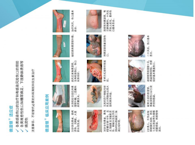 德濕銀敷料、銀離子