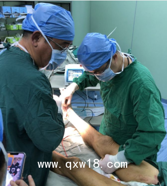 博激VELAS30B大隱靜脈曲張治療儀