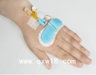 體表導管固定器