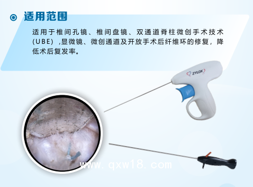 國(guó)產(chǎn)骨科非帶量高值耗材一次性纖維環(huán)縫合器