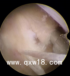 纖維環(huán)縫合器省區(qū)域有掛網(wǎng)價格嗎