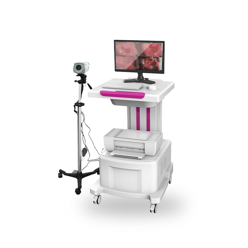 數(shù)碼電子陰道鏡