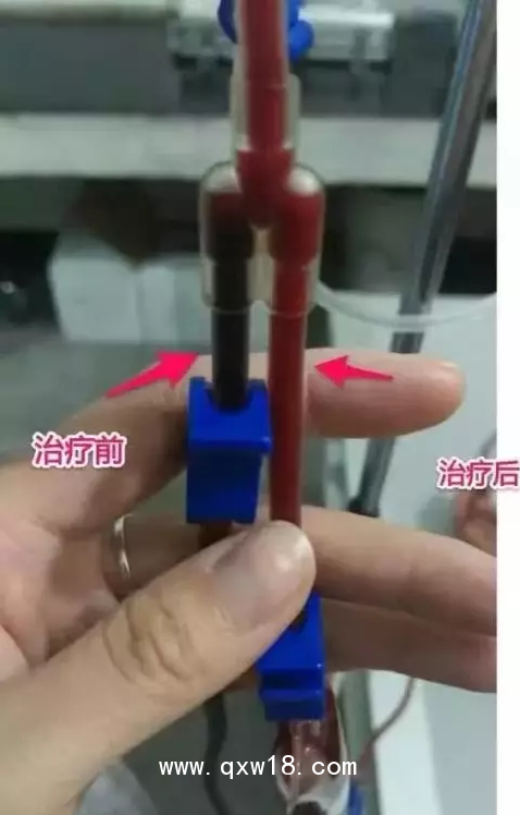 醫(yī)用臭氧治療儀 臭氧治療儀適應(yīng)癥 臭氧治療儀廠家排行