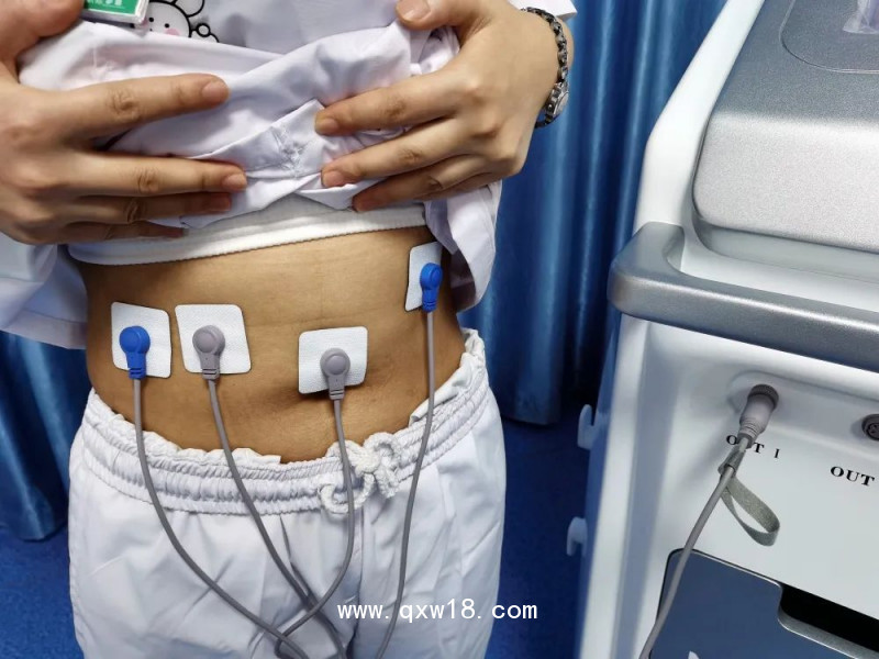 中頻胃腸治療儀 術(shù)后排氣綜合治療 胃腸動(dòng)力恢復(fù)