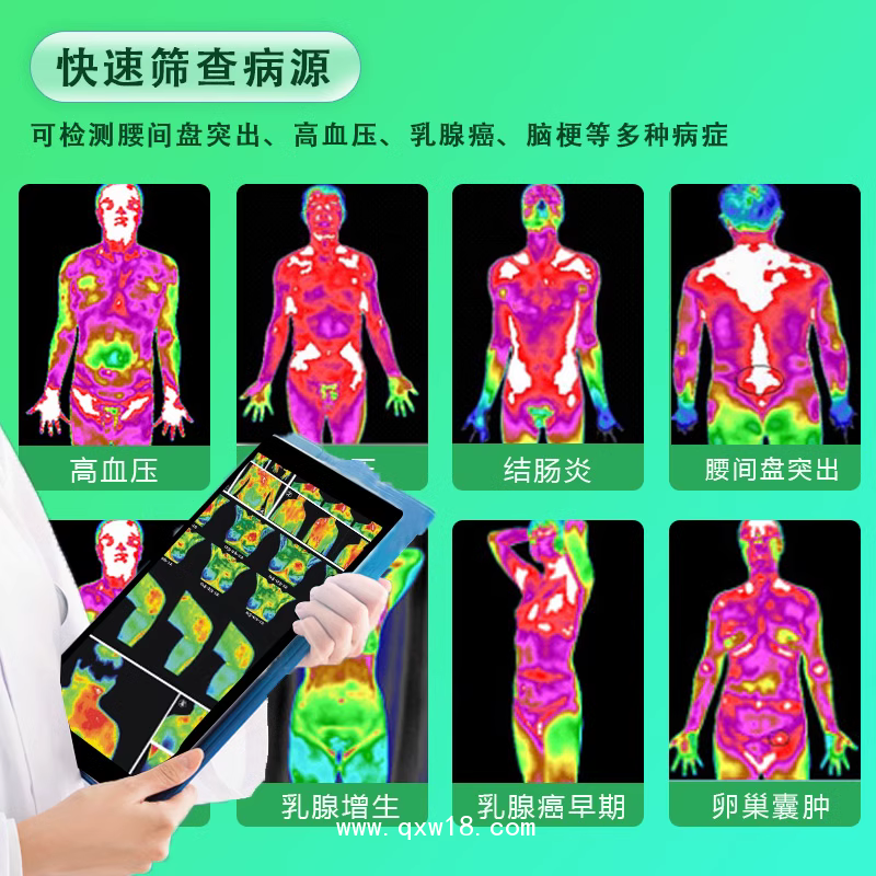 中醫(yī)熱ct體質(zhì)健康測(cè)試儀醫(yī)用紅外線(xiàn)成像儀透視機(jī)CT醫(yī)用成像儀