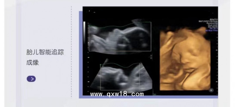 彩色超聲診斷儀