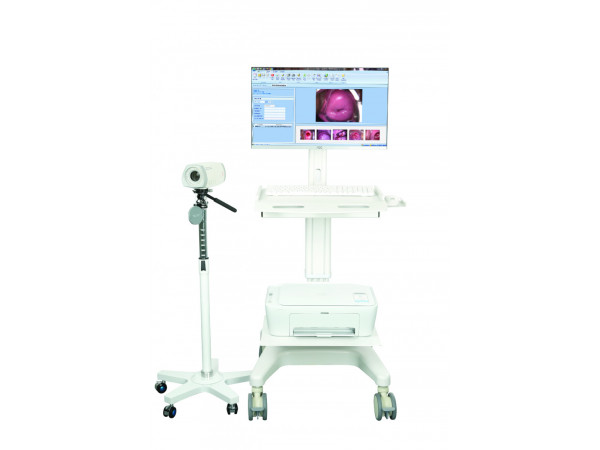 索吉瑞電子陰道鏡、電子陰道顯微鏡 SY02