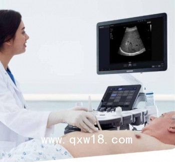 醫(yī)用超聲診斷儀HS40、XH40型號(hào)三星麥迪遜彩超