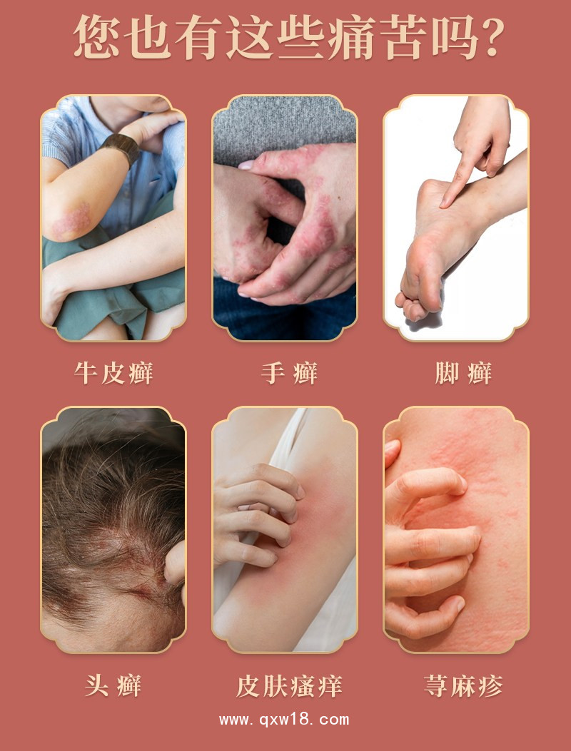 導(dǎo)光凝膠灸熱泥泥灸批發(fā)代理定制定做醫(yī)院診所